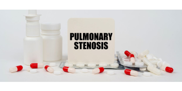 Stenoza pulmonara – simptome, cauze, tratament