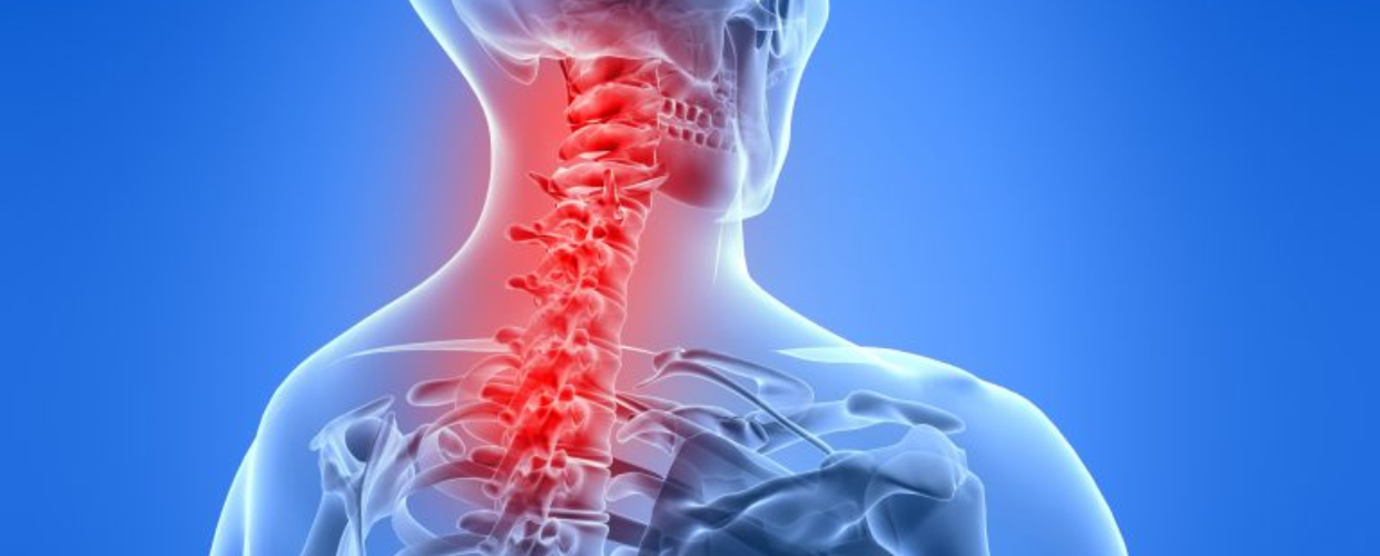 Discopatia vertebrala sau durerea de spate